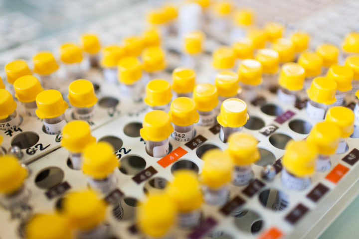 Laboratoire D Analyse Médicale La Celle Saint Cloud